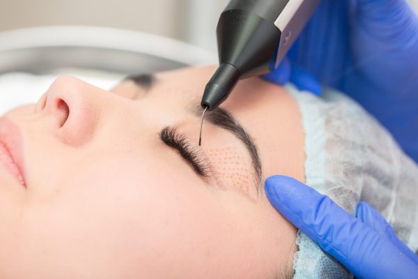 Cosmetic,Procedure,To,Strengthen,The,Skin,Of,The,Eyelids.,Non-surgical